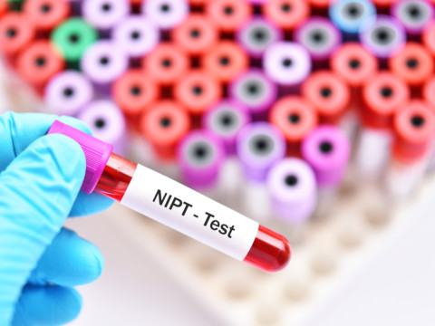 Kilpailullinen neuvottelumenettely NIPT-testausprosessin hankinnassa – Case HUS Diagnostiikkakeskus